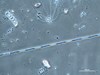 Photo of Pseudo-nitzschia spp. (large-celled)